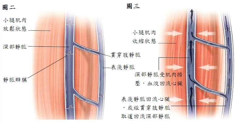 认识静脉曲张 | 社区健康园地 | 中坜天晟医院–杨梅天成医院–TEN-CHEN MEDICAL GROUP